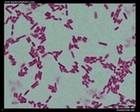 Escherichia coli microscopy